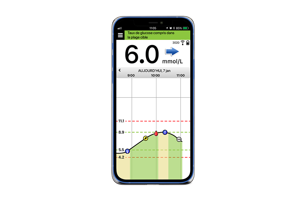 Écran de téléphone présentant la technologie de CGM sur l’application du système Eversense.