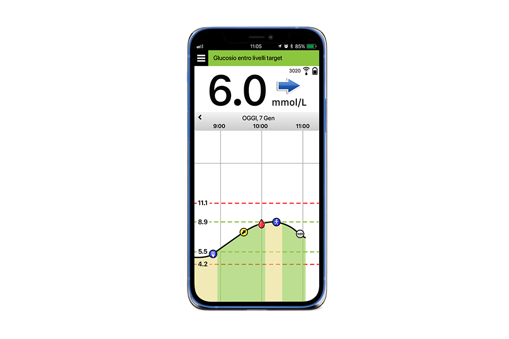 Donna con in mano un cellulare con informazioni sul diabete di Eversense.