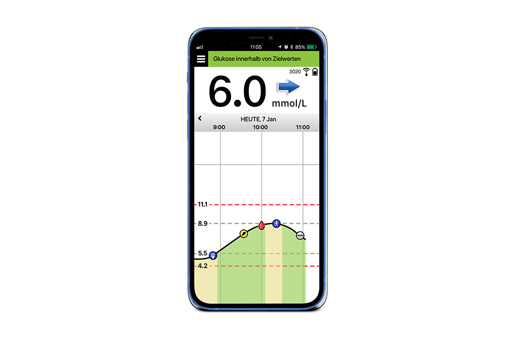 Handybildschirm, auf dem Eversense System App mit CGM-Technik zu sehen ist