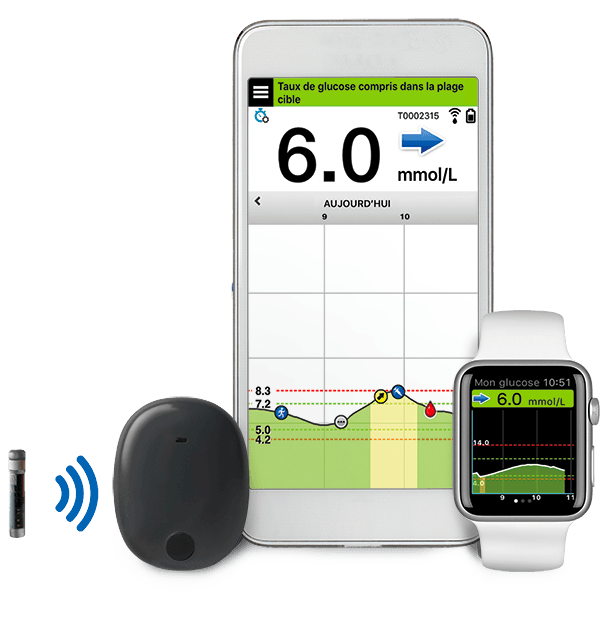 Eversense XL