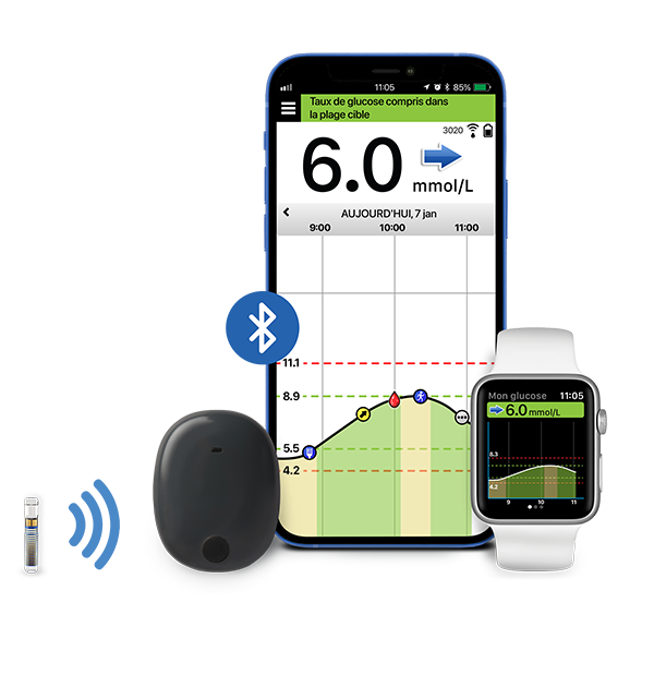 Eversense XL