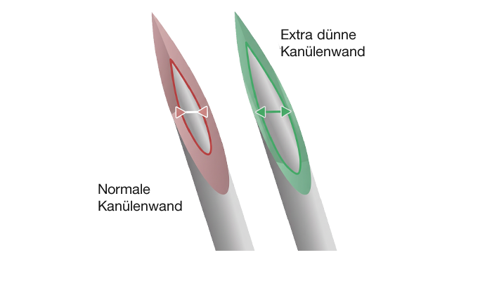 Grafik zur Veranschaulichung dünner Nadelwände